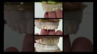 Dental Videos From around the World 7