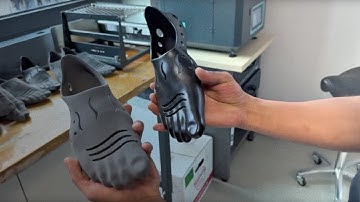 3D Printed SLS Prosthesis: Restoring Mobility After Cancer