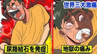 【世界三大激痛】地獄の腎結石...下腹部を切り裂く痛さ！