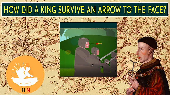 How did king henry V survive an arrow to the face? The King Who Was Badly Injured In Battle