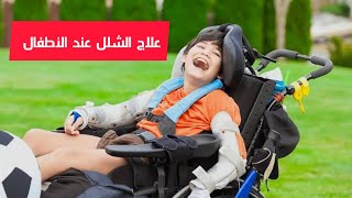 افضل مستشفى العلاج الطبيعي في الهند | علاج الشلل عند الكبار و الأطفال