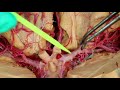 Circle of Willis Anatomy