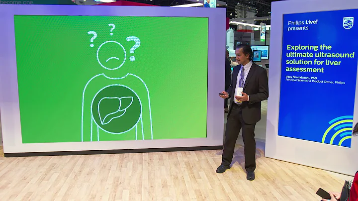 Exploring the ultimate ultrasound solution for liv...