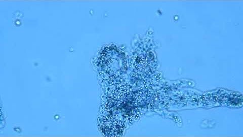 Amoeba movement for student