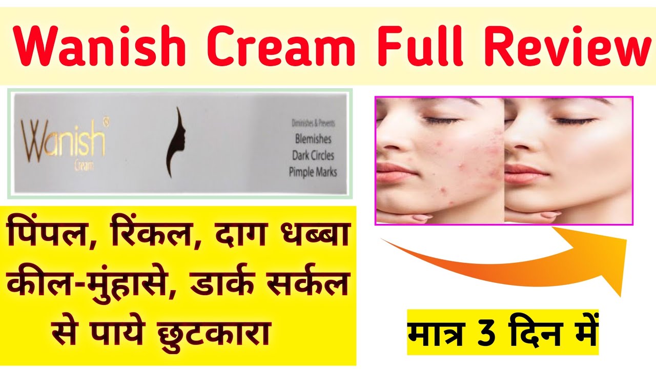 Wanish Cream / Wanish cream review in hindi / Wanish cream Use / Uses