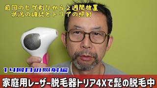 トリアX4で脱毛中[前回から２週間経過、ヒゲの様子を確認し14回目の脱毛しています］