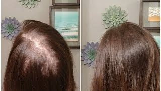 How to deal with that crazy part in the back of your head?