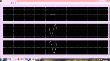 THIẾT KẾ BỘ ĐIỀU KHIỂN 4Q CHO ĐỘNG CƠ BLDC BẰNG MATLAB