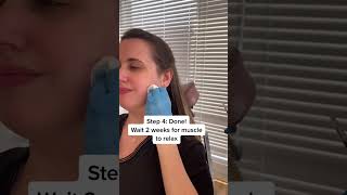 Dermatologist Demonstrating Tmj Injections In The Office