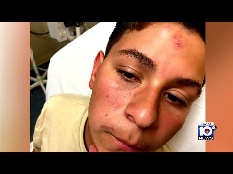 Police investigating teen's brutal beatdown at West Broward High School