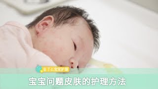 宝宝皮肤干燥、长湿疹、头发发炎时该如何护理？