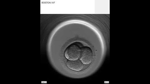 Blastocyst Video | Science at Boston IVF