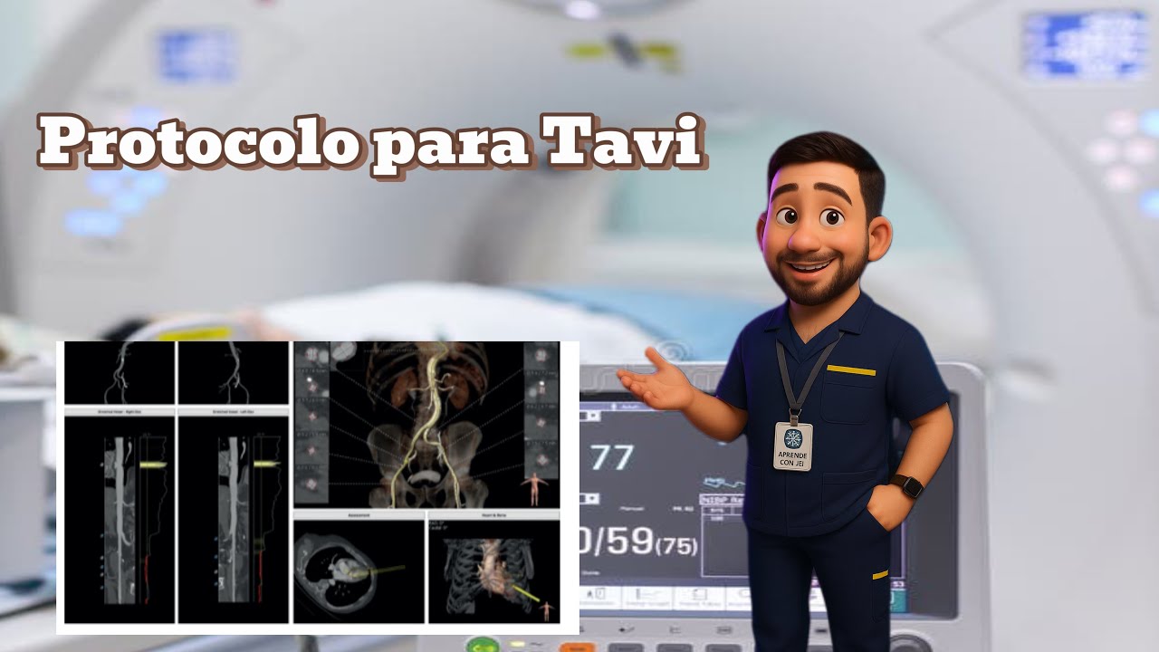 PROTOCOLO COMPLETO DE ANGIO-TC PARA TAVI | Guía actualizada para Tecnólogos en Imágenes Diagnósticas