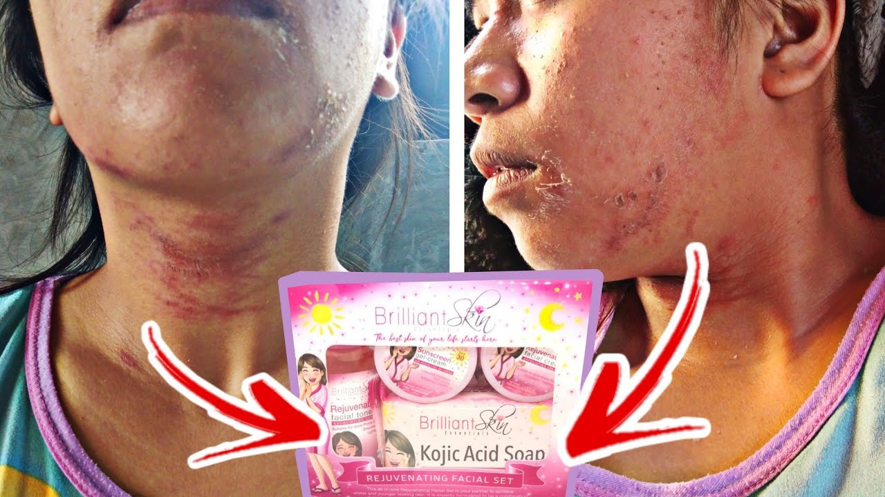 BRILLIANT SKIN REJUVENATING SET HONEST REVIEW Ep 1 YouTube brilliant-skin-rejuvenating-set-honest-review-ep-1-youtube