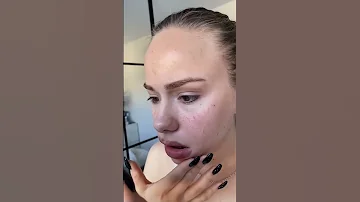 Черви ч.6🙀 Аллергия!
