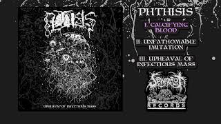 Phthisis - Upheaval of Infectious Mass