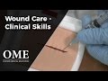Wound Care - Clinical Skills