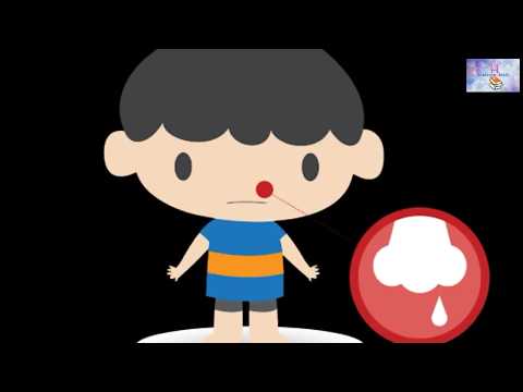 nose-bleeding-|epistaxis|-define,-causes,diet-&-treatment|-नाक-से-खून-बहने-के-रोकने-के-उपाय।