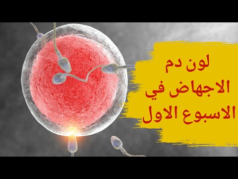 فيديو: كيف يبدو النزيف الساقطي؟