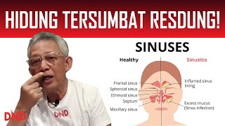 Hidung Tersumbat Resdungapa Nak Buat