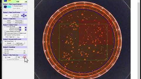 Automated Colony Counting - BIOMIC V3 Microbiology System