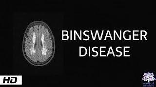 Binswanger disease, Causes , Signs and Symptoms, Diagnosis and Treatment.