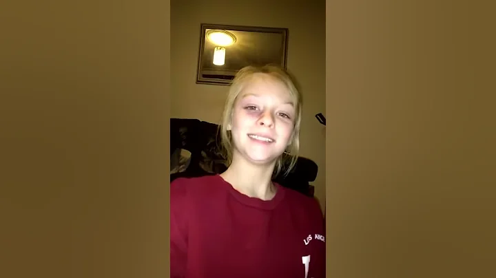 I had a black eye. Bottle flip chalange
