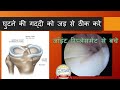 Meniscus Root Tear and its Repair (Hindi). घुटने की गद्दी को जड़ से ठीक करे , घुटने के घिसारे से बचे