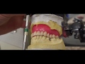 The top tricks and techniques to make dentures look real