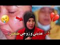 اخي علقني في الشجرة و عذب ني