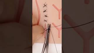 El Nice Nudo: Parte 2