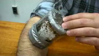 Hundreds of Bed Bugs Biting a Man's Arm Hundreds of Bed Bugs Biting a Man's Arm