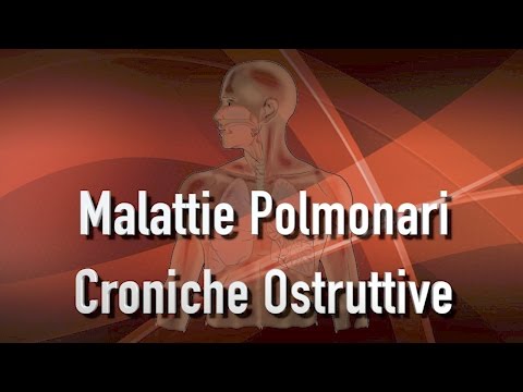 Video: Differenza Tra Malattia Polmonare Ostruttiva E Restrittiva