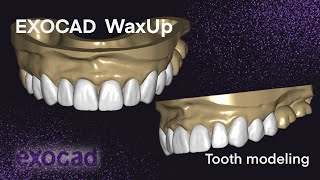 Exocad WaxUp I Tooth Modeling 14