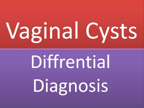 Video: Vaginal Cysta: Typer, Symptom Och Diagnos