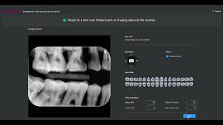 How to – Flip back-side-exposed Planmeca ProScanner 2.0 images in Planmeca Romexis