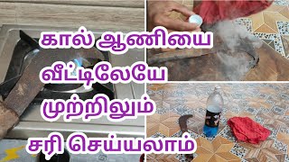 கல ஆணய வடடலய மறறலம கணமகக How To Get Rid Of Corns Naturally At Home