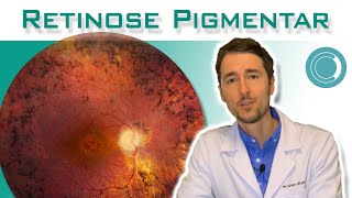 Retinose Pigmentar - Sintomas E Diagnóstico