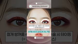 절개 쌍수, 눈매교정, 눈밑지, 하안검 테이핑 제거는 언제부터? #shorts