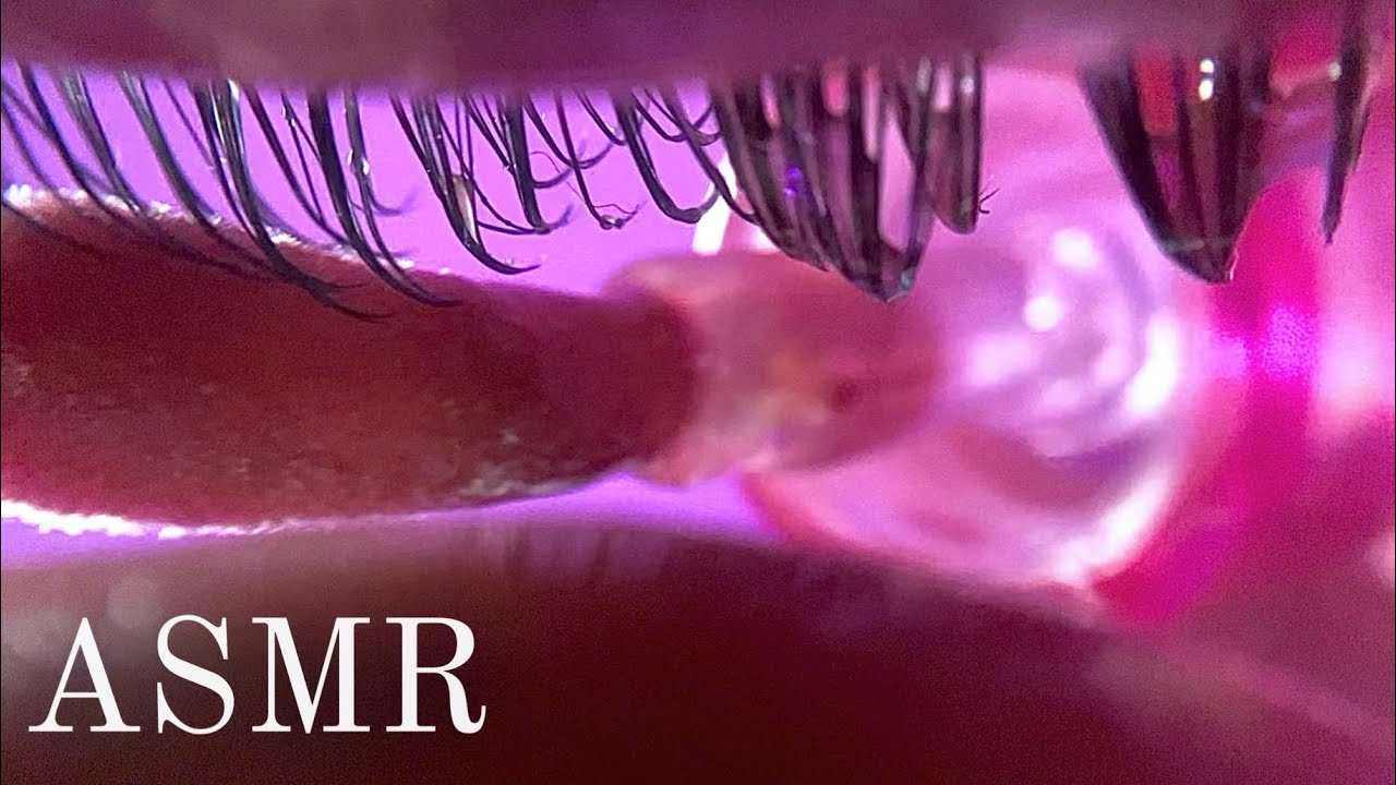 ASMR EYE CLEANING 👁️✨ PART 5