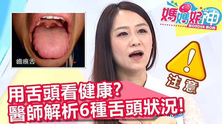 用舌頭看健康？中醫師解析6種舌頭狀況！「齒痕舌」表示腸胃代謝差？【媽媽好神】20191001 part2/4 EP523 Julie  林舒語 - 天天要聞