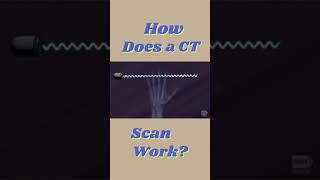 How Does a CT Scan Work ? | CT Scan Working screenshot 5