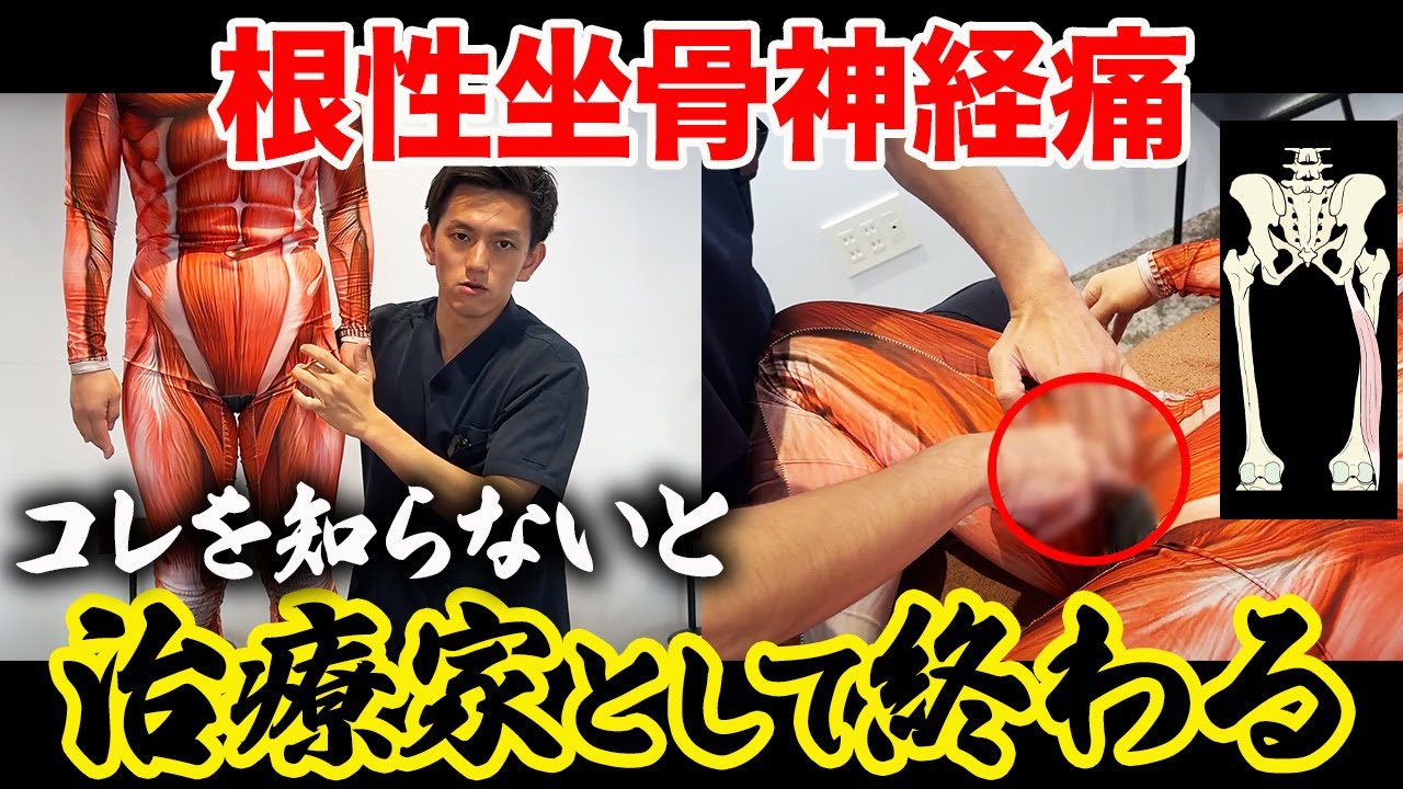 Extra Paid※] There's More Than Just One Cause of Sciatica! We'll