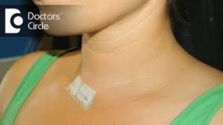 Can Thyroid Grow Back After Total Thyroidectomy? - Dr. Anantharaman Ramakrishnan