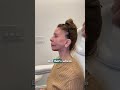 Full face rejuvenation. Part 2