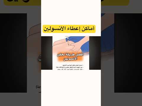 اماكن حقن الأنسولين مرضى السكرى الانسولين   مرضى السكر التمريض