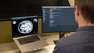 UQ research: the road to discovery