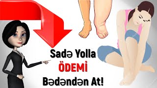 Şişkinliyi Və Ödemi Bu Yolla Aradan Qaldır