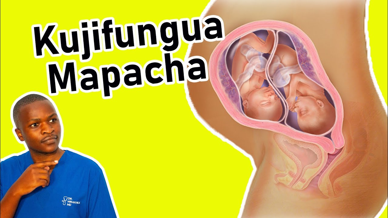Je Mjamzito WA Mapacha Anaweza Kujifungua Kawaida AU Kwa Upasuaji? | Uchungu wa Mimba ya Mapacha!!