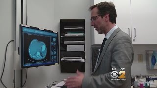 Dr. Max Gomez: Melanoma Study